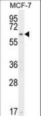 CTDSPL2 Antibody western blot of MCF-7 cell line lysates (35 ug/lane). The CTDSPL2 antibody detected the CTDSPL2 protein (arrow).