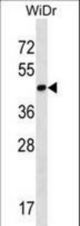 THAP11 Antibody western blot of WiDr cell line lysates (35 ug/lane). The THAP11 antibody detected the THAP11 protein (arrow).