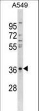 CTGF Antibody western blot of A549 cell line lysates (35 ug/lane). The CTGF antibody detected the CTGF protein (arrow).