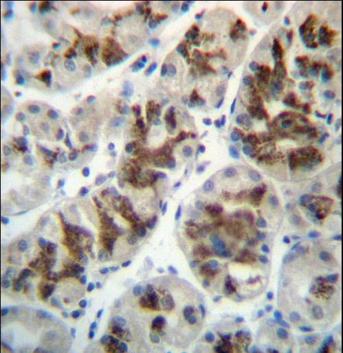 CTGF Antibody immunohistochemistry of formalin-fixed and paraffin-embedded human stomach tissue followed by peroxidase-conjugated secondary antibody and DAB staining.