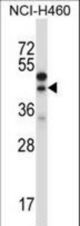 CTGF Antibody western blot of NCI-H460 cell line lysates (35 ug/lane). The CTGF antibody detected the CTGF protein (arrow).