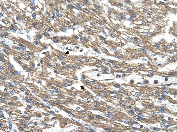 CTH antibody LS-C80810 was used in IHC to stain formalin-fixed, paraffin-embedded human heart.
