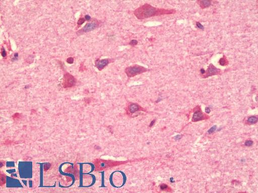 Anti-CHUK / IKKA / IKK Alpha antibody IHC staining of human brain, cortex. Immunohistochemistry of formalin-fixed, paraffin-embedded tissue after heat-induced antigen retrieval.