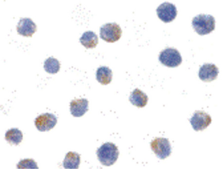 Immunocytochemistry of IKK alpha in Jurkat cells with IKK alpha antibody at 1ug/ml.