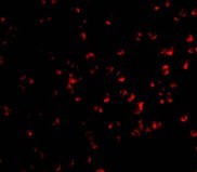 Immunofluorescence of IKK alpha in Jurkat cells with IKK alpha antibody at 10 ug/mL.