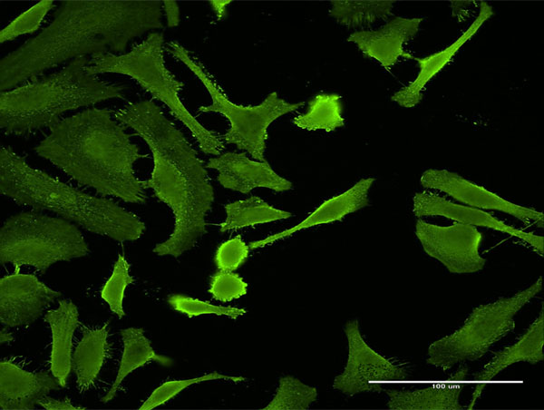 Immunofluorescence of monoclonal antibody to CTLA4 on HeLa cell . [antibody concentration 15 ug/ml]