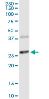 CTLA4 monoclonal antibody (M06), clone 2F1. Western Blot analysis of CTLA4 expression in human pancreas.