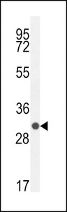 IDDM12 Antibody western blot of WiDr cell line lysates (35 ug/lane). The IDDM12 antibody detected the IDDM12 protein (arrow).