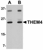 Western blot of THEM4 in human liver tissue lysate with THEM4 antibody at (A) 1 and (B) 2 ug/ml.
