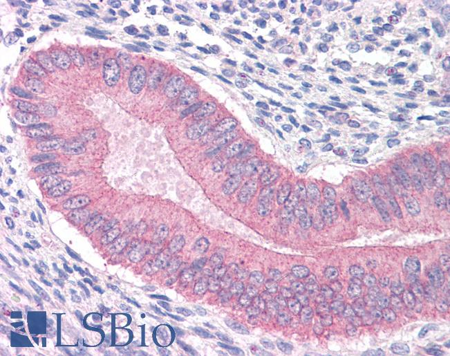 Anti-CTNNA1 antibody IHC of human uterus. Immunohistochemistry of formalin-fixed, paraffin-embedded tissue after heat-induced antigen retrieval. Antibody LS-B4457 concentration 3.75 ug/ml.