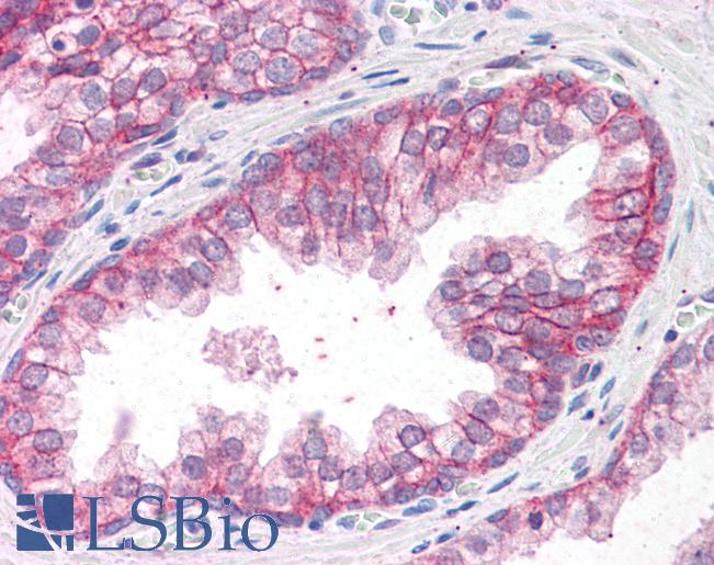 Anti-CTNNA1 antibody IHC of human prostate. Immunohistochemistry of formalin-fixed, paraffin-embedded tissue after heat-induced antigen retrieval. Antibody LS-B4457 concentration 3.75 ug/ml.