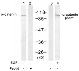 Western blot of extracts from A431 cells untreated or treated with EGF (200 ng/ml, 30 min) using Rabbit Anti- alpha-Catenin (Ab-641) Polyclonal Antibody (LS-C51659, Lane 1 and 2) and Rabbit Anti- alpha-Catenin (Phospho-Ser641) Polyclonal Antibody