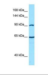 Western blot of Human PANC1. CTNNA2 antibody dilution 1.0 ug/ml.