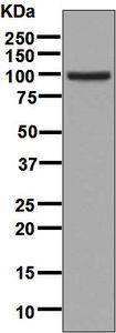 Western blot analysis on human heart lysate using anti-Alpha T-Catenin antibody.