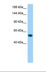 Western blot of Jurkat. BMP8B antibody dilution 1.0 ug/ml.