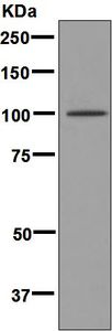 Western blot analysis on fetal heart lysate using anti-Alpha T-Catenin antibody.