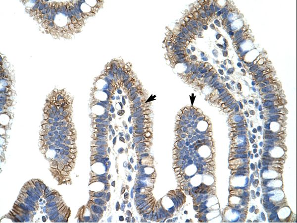 CTNNB1 / Beta Catenin antibody LS-C31415 was used in IHC to stain formalin-fixed, paraffin-embedded human intestine.