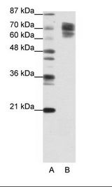A: Marker, B: Jurkat Cell Lysate