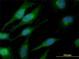 Immunofluorescence of monoclonal antibody to CTNNB1 on HeLa cell. [antibody concentration 10 ug/ml]