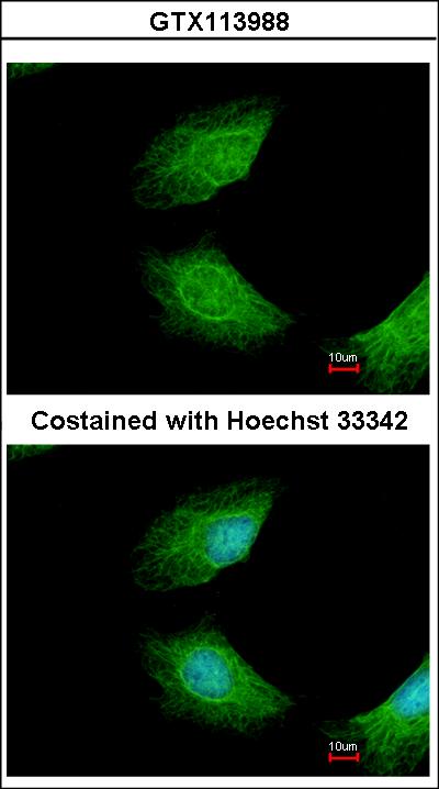 Immunofluorescence of methanol-fixed HeLa using CIAPIN1 antibody at 1:200 dilution.