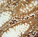 C1orf51 antibody immunohistochemistry of formalin-fixed and paraffin-embedded human large intestine followed by peroxidase-conjugated secondary antibody and DAB staining.