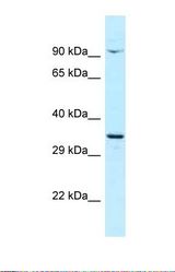 Western blot of Human OVCAR-3 . CTNNBL1 antibody dilution 1.0 ug/ml.