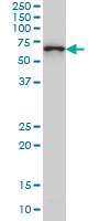 CTNNBL1 monoclonal antibody (M01), clone 5F1 Western blot of CTNNBL1 expression in HeLa NE.