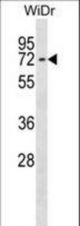 CTNNBL1 Antibody western blot of WiDr cell line lysates (35 ug/lane). The CTNNBL1 antibody detected the CTNNBL1 protein (arrow).