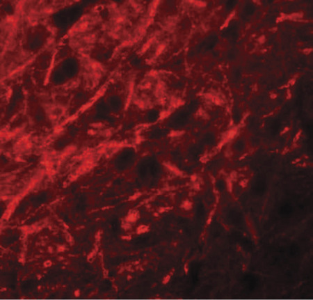 Immunofluorescence of CTNNBL1 in mouse brain tissue with CTNNBL1 antibody at 20 ug/ml.