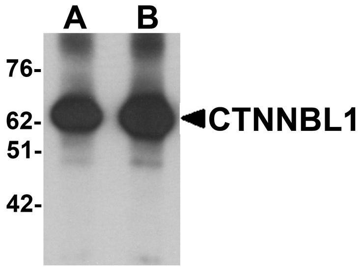 Western blot analysis of CTNNBL1 in human brain tissue lysate with CTNNBL1 antibody at (A) 1 and (B) 2 ug/ml.