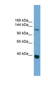 CTNND1 / p120CTN antibody LS-C116431 Western blot of HepG2 cell lysate.