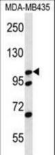 CTNND2 Antibody western blot of MDA-MB435 cell line lysates (35 ug/lane). The CTNND2 antibody detected the CTNND2 protein (arrow).