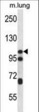 CTNND2 Antibody western blot of mouse lung tissue lysates (35 ug/lane). The CTNND2 antibody detected the CTNND2 protein (arrow).