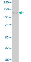 CTNND2 monoclonal antibody (M01), clone 6E11 Western Blot analysis of CTNND2 expression in PC-12.