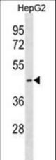 CTNS Antibody western blot of HepG2 cell line lysates (35 ug/lane). The CTNS antibody detected the CTNS protein (arrow).