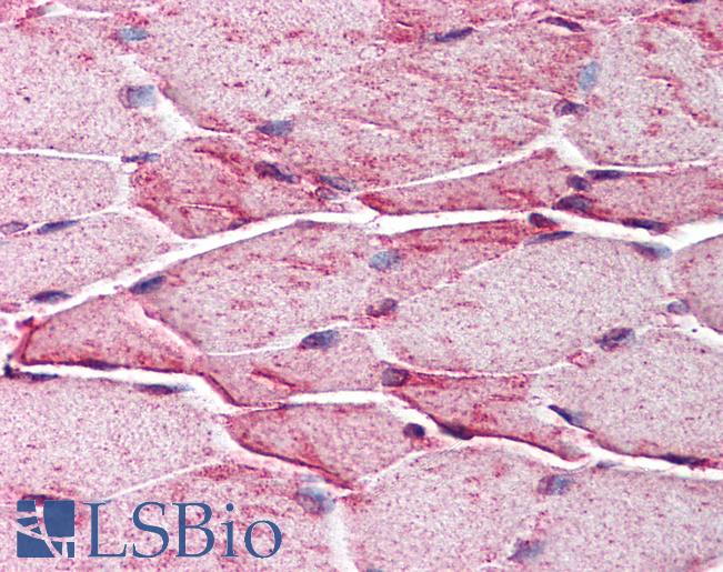 Anti-CTNS antibody IHC of human skeletal muscle. Immunohistochemistry of formalin-fixed, paraffin-embedded tissue after heat-induced antigen retrieval. Antibody LS-B205 concentration 25 ug/ml.
