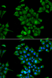 Immunofluorescence analysis of HeLa cell using CTNS antibody. Blue: DAPI for nuclear staining.