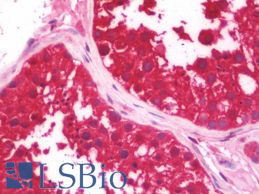 Anti-CTNS / Cystinosin antibody IHC staining of human testis. Immunohistochemistry of formalin-fixed, paraffin-embedded tissue after heat-induced antigen retrieval. Antibody LS-B10982 dilution 1:100.