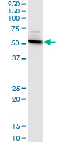 CTNS monoclonal antibody (M09), clone 5G6. Western Blot analysis of CTNS expression in human liver.