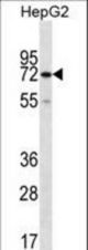 CTPS2 Antibody western blot of HepG2 cell line lysates (35 ug/lane). The CTPS2 antibody detected the CTPS2 protein (arrow).