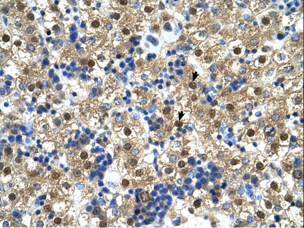 CTPS antibody LS-C80811 was used in IHC to stain formalin-fixed, paraffin-embedded human liver.