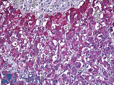 Anti-CIB2 antibody IHC of human adrenal medulla. Immunohistochemistry of formalin-fixed, paraffin-embedded tissue after heat-induced antigen retrieval. Antibody LS-B5665 concentration 10 ug/ml.