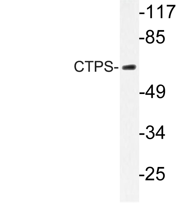 Western blot of CTPS (K109) pAb in extracts from HUVEC cells.