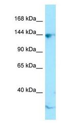 CTR9 antibody Western Blot of Jurkat.