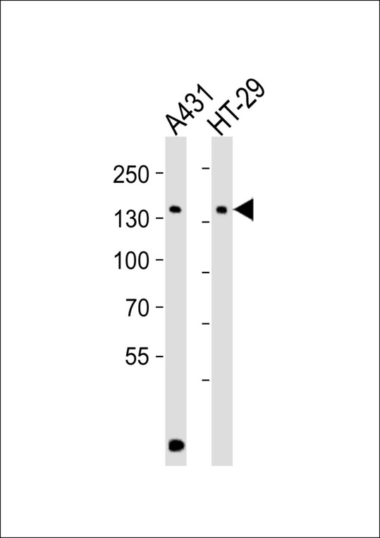 Western blot of lysates from A431, HT-29 cell line (from left to right) with Mouse Ctr9 Antibody. Antibody was diluted at 1:1000 at each lane. A goat anti-rabbit IgG H&L (HRP) at 1:10000 dilution was used as the secondary antibody. Lysates at 35 ug per lane.