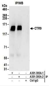 Detection of Human CTR9 by Western Blot of Immunoprecipitates. Samples: Whole cell lysate (1 mg for IP; 20% of IP loaded) from HeLa cells. Antibodies: Affinity purified rabbit anti-CTR9 antibody used for IP at 6 ug/mg lysate. CTR9 was also immunoprecipitated by a previous lot of this antibody. For blotting immunoprecipitated CTR9, was used at 1 ug/ml. Detection: Chemiluminescence with an exposure time of 10 seconds.