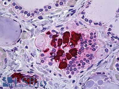 Anti-CIB2 antibody IHC of human thyroid, c-cells. Immunohistochemistry of formalin-fixed, paraffin-embedded tissue after heat-induced antigen retrieval. Antibody LS-B5665 concentration 10 ug/ml.