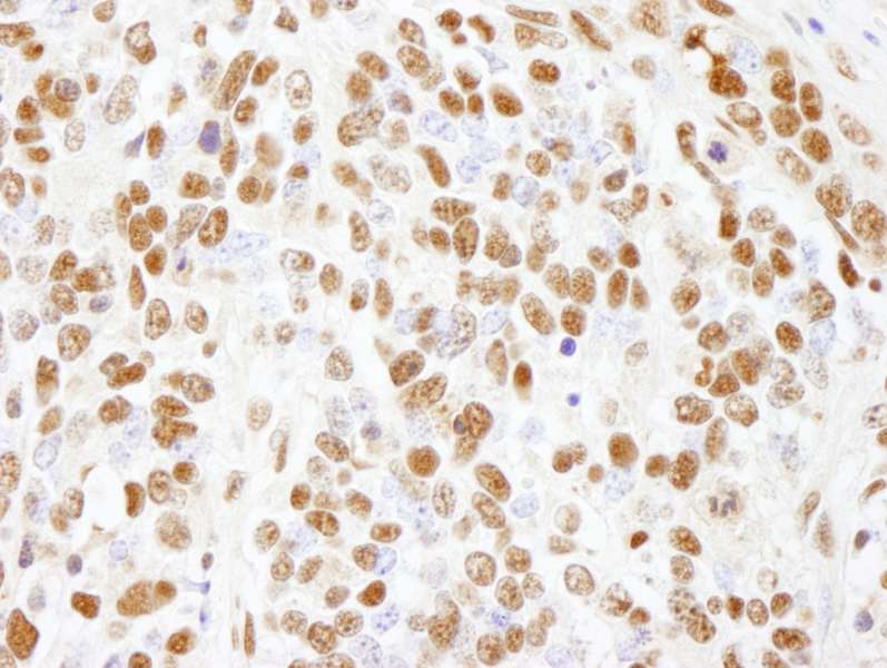 Detection of Mouse CTR9 by Immunohistochemistry. Sample: FFPE section of mouse teratoma. Antibody: Affinity purified rabbit anti-CTR9 used at a dilution of 1:250.