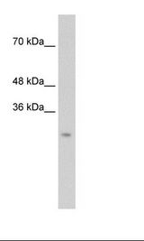 Transfected 293T Cell Lysate