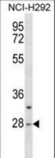 CTRL Antibody western blot of NCI-H292 cell line lysates (35 ug/lane). The CTRL antibody detected the CTRL protein (arrow).